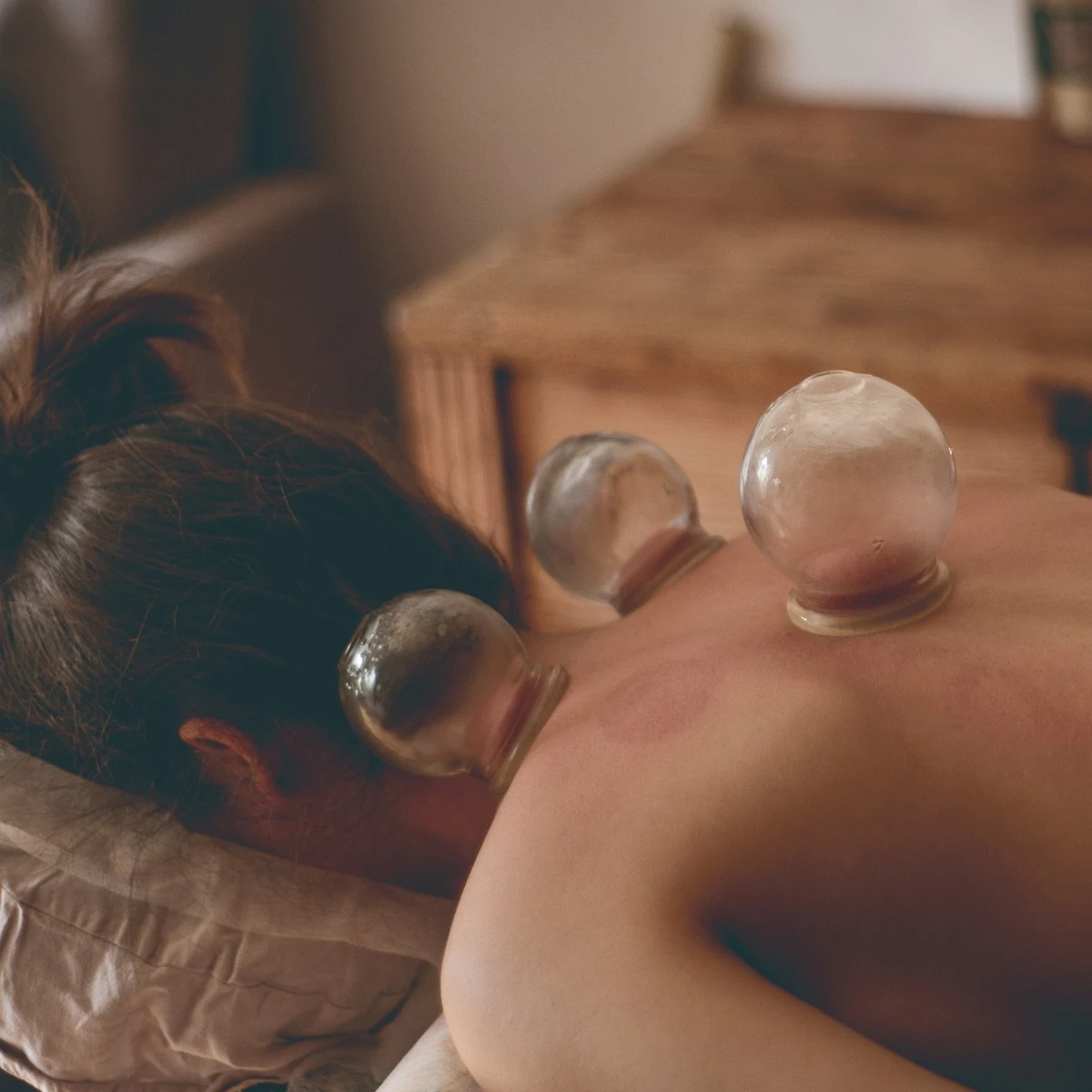 Cupping therapy (ventosa) at LetMein Beauty